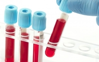 Ученые: Возраст убийцы можно определить по капле крови