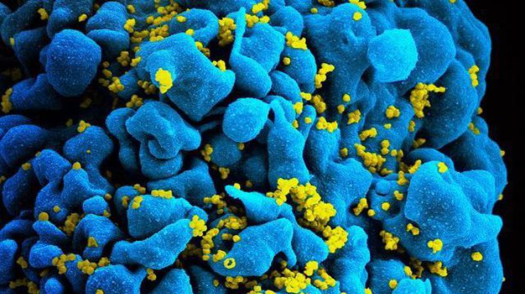 Ученые нашли способ бороться с ВИЧ