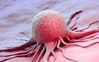 Что вызывает рак: биологи сделали открытие