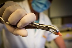 В РФ завели дело на стоматолога, которая удалила пациенту 22 здоровых зуба